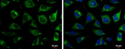 Immunocytochemistry/Immunofluorescence: RRM2 Antibody [NBP1-31661] - HeLa cells were fixed in 4% paraformaldehyde at RT for 15 min. Green: RRM2 protein stained by RRM2 antibody [N1C1] diluted at 1:500. Blue: Hoechst 33342 staining. Scale bar = 10 um.