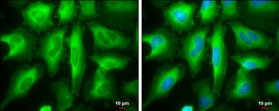 Immunocytochemistry/Immunofluorescence: RRM2 Antibody [NBP1-31661] - HeLa cells were fixed in ice-cold MeOH for 5 min. Green: RRM2 protein stained by RRM2 antibody [N1C1] diluted at 1:1000. Blue: Hoechst 33342 staining. Scale bar = 10 um.