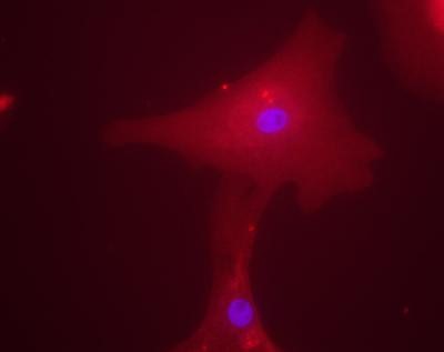 Immunocytochemistry/Immunofluorescence: CHREBP Antibody [NB400-136] - Staining of a human hepatocyte using NB400-136.  Overlay staining of ChREBP (rhodamine red) and DAPI nuclear staining (blue).