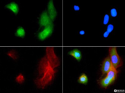 Immunocytochemistry/Immunofluorescence: ABCB5 Antibody [NBP1-77687] - ABCB5 antibody was tested in A431 cells with FITC (green). Nuclei and actin were counterstained with DAPI (blue) and Phalloidin (red).