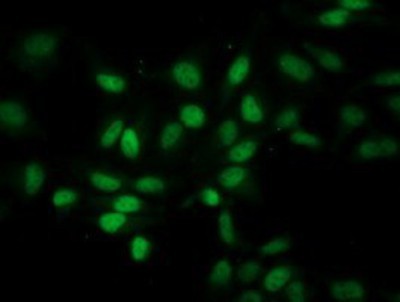 Immunocytochemistry/Immunofluorescence: Eukaryotic translation initiation factor 1 Antibody (2B9) [NBP2-00702] - Immunofluorescent staining of HeLa cells using anti-Eukaryotic translation initiation factor 1 mouse monoclonal antibody.