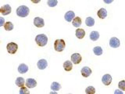 Immunocytochemistry/Immunofluorescence: XBP1 Antibody [NBP1-77252] - HepG2 cells with XBP-1 antibody at 2 ug/ml.