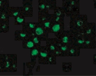 Immunocytochemistry/Immunofluorescence: APAF-1 Antibody [NBP1-77000] - Immunofluorescence of Apaf1 in K562 cells with Apaf1 antibody at 10 ug/mL.