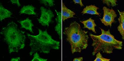 Immunocytochemistry/Immunofluorescence: MuRF1/TRIM63 Antibody [NBP1-31207] - HeLa cells were fixed in 4% paraformaldehyde at RT for 15 min. Green: MURF1 protein stained by MURF1 antibody [N1], N-term diluted at 1:200. Red: alpha Tubulin, a cytoskeleton marker, stained by alpha Tubulin antibody [114]  diluted at 1:1000. Blue: Hoechst 33342 staining.
