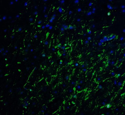 Immunocytochemistry/Immunofluorescence: LMX1A Antibody [NBP2-41193] - Staining of LMX1A in mouse brain tissue with LMX1A Antibodyat 20 ug/mL.