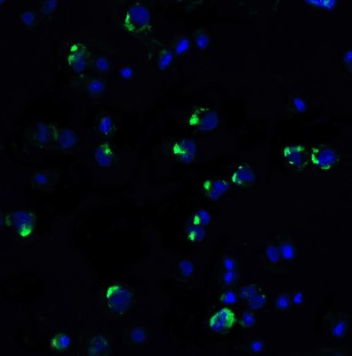 Immunofluorescence: PD-1 Antibody [NBP1-77277] - PD-1 in PD-1-transfected HEK293 cells with PD-1 antibody at 20 ug/ml.