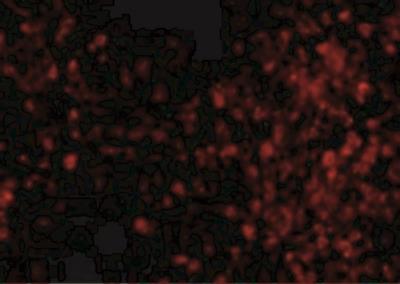Immunocytochemistry/Immunofluorescence: TRPC6 Antibody [NBP1-77260] - Immunofluorescence of TRPC6 in Mouse Lung cells with TRPC6 antibody at 20 ug/mL.