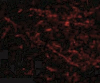 Immunocytochemistry/Immunofluorescence: Sirtuin 2/SIRT2 Antibody [NBP1-76879] - Human Brain tissue with SIRT2 antibody at 5 ug/mL.