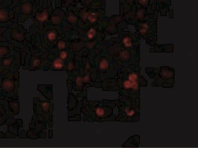 Immunocytochemistry/Immunofluorescence: TRAIL R3/TNFRSF10C Antibody [NBP1-76881] - Immunofluorescence of DcR1 in Hela cells with DcR1 antibody at 20 ug/mL.