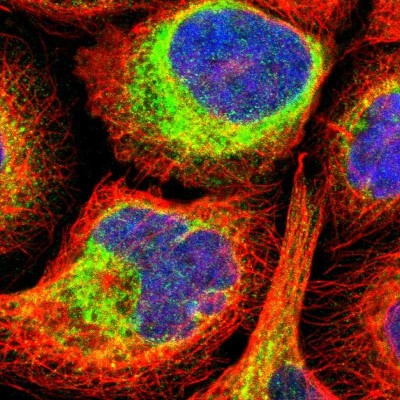 Immunocytochemistry/Immunofluorescence: FKBP7 Antibody [NBP1-83889] - Immunofluorescent staining of human cell line A-431 shows localization to endoplasmic reticulum.