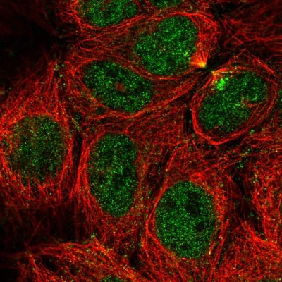 Immunocytochemistry/Immunofluorescence: CaMKV Antibody [NBP1-82660] - Immunofluorescent staining of human cell line CACO-2 shows localization to nucleoplasm & cytokinetic bridge.