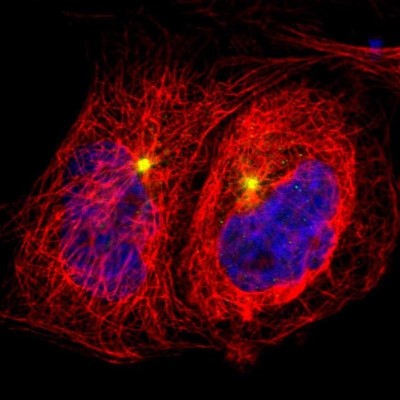 Immunocytochemistry/Immunofluorescence: CaMKV Antibody [NBP1-82660] - Staining of human cell line A-431 shows positivity in centrosome.