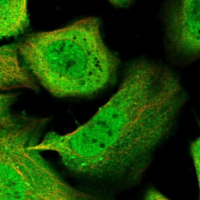 Immunocytochemistry/Immunofluorescence: KLHL7 Antibody [NBP1-82871] - Immunofluorescent staining of human cell line U-2 OS shows localization to nucleoplasm, plasma membrane & cytosol.