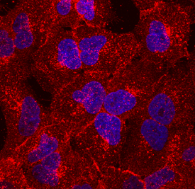 TM4SF1/L6 was detected in immersion fixed A549 human lung carcinoma cell line using Mouse Anti-Human TM4SF1/L6 Monoclonal Antibody (Catalog # MAB8164) at 10 µg/mL for 3 hours at room temperature. Cells were stained using the NorthernLights™ 557-conjugated Anti-Mouse IgG Secondary Antibody (red; Catalog # NL007) and counterstained with DAPI (blue). Specific staining was localized to cell membranes. View our protocol for Fluorescent ICC Staining of Cells on Coverslips.