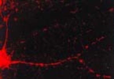 Immunocytochemistry/Immunofluorescence: CaM Kinase II alpha Antibody (6G9) [NB100-1983] - Tissue: dissociated hippocampal neurons. Species: Mouse. Fixation: Cold 4% paraformaldehyde/0.2% glutaraldehyde in 0.1M sodium phosphate buffer. Primary Antibody: Mouse Anti-CaMKII Monoclonal Antibody at 1:1000 for 12 hours at 4C. Secondary Antibody: FITC Goat Anti-Mouse IgG (green) at 1:50 for 30 minutes at RT. Magnification: 10X. Courtesy of: Mary Kennedy, Caltech.