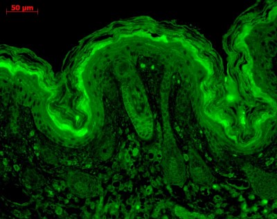 Immunocytochemistry/Immunofluorescence: CaM Kinase II alpha Antibody (6G9) [NB100-1983] - Tissue: backskin. Species: Mouse. Fixation: Bouins Fixative and paraffin-embedded. Primary Antibody: Mouse Anti-CaMKII Monoclonal Antibody at 1:100 for 1 hour at RT. Secondary Antibody: FITC Goat Anti-Mouse (green) at 1:50 for 1 hour at RT. Localization: Hair follicles, epidermis.