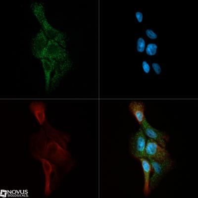 Immunocytochemistry/Immunofluorescence: Ceramide Kinase Antibody [NB100-2911] - Ceramide Kinase antibody was tested in A431 cells with Dylight 488 (green). Nuclei and alpha-tubulin were counterstained with DAPI (blue) and Dylight 550 (red).