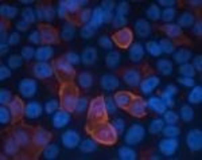 Immunocytochemistry/Immunofluorescence: SARS Nucleocapsid Protein Antibody (Ncap11) [NBP2-24747] - Transfected HeLa cells were stained with this antibody at 1:500 dilution.