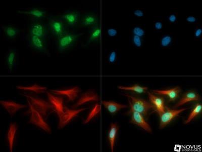 Immunocytochemistry/Immunofluorescence: Tankyrase 1 Antibody [NB100-186] - Tankyrase antibody was tested in HeLa cells with Dylight 488 (green). Nuclei and alpha-tubulin were counterstained with DAPI (blue) and Dylight 550 (red).