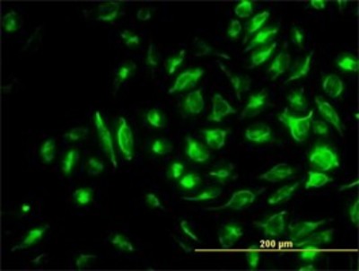 Immunocytochemistry/Immunofluorescence: NM23-H2/NME2 Antibody (1D3) [H00004831-M06] - Analysis of monoclonal antibody to NME2 on HeLa cell. Antibody concentration 10 ug/ml