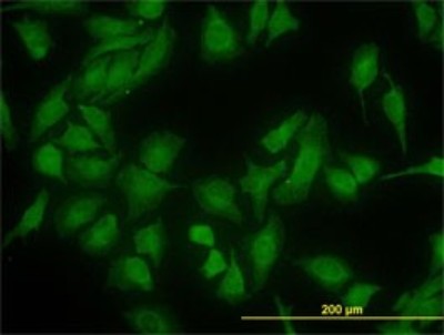Immunocytochemistry/Immunofluorescence: DNAJC10 Antibody (3C4) [H00054431-M01] - Analysis of monoclonal antibody to DNAJC10 on HeLa cell. Antibody concentration 10 ug/ml.