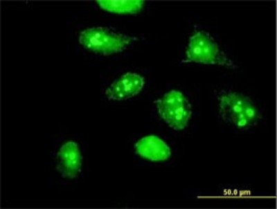 Immunocytochemistry/Immunofluorescence: HSPC111 Antibody [H00051491-B01P] - Analysis of purified antibody to HSPC111 on HeLa cell. (antibody concentration 10 ug/ml)
