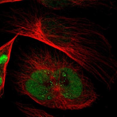 Immunocytochemistry/Immunofluorescence: EMP2 Antibody [NBP1-86847] - Staining of human cell line U-251 MG shows localization to nucleoplasm.