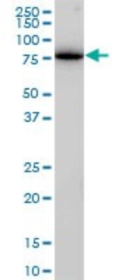 Western Blot: Clathrin interactor 1 Antibody (1E6) [H00009685-M03] - Analysis of ENTH expression in Jurkat (Cat # L017V1).