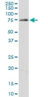Western Blot: Clathrin interactor 1 Antibody (1E6) [H00009685-M03] - Analysis of ENTH expression in PC-12 (Cat # L012V1).