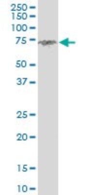 Western Blot: Clathrin interactor 1 Antibody (1E6) [H00009685-M03] - Analysis of ENTH expression in Raw 264.7 (Cat # L024V1).