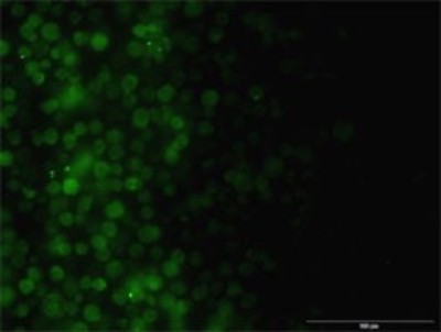 Immunocytochemistry/Immunofluorescence: ILK Antibody (4F10) [H00003611-M01] - Analysis of monoclonal antibody to ILK on Jurkat cell. Antibody concentration 10 ug/ml.