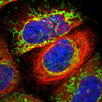 Immunocytochemistry/Immunofluorescence: MPST Antibody [NBP1-82617] - Immunofluorescent staining of human cell line A-431 shows localization to mitochondria.