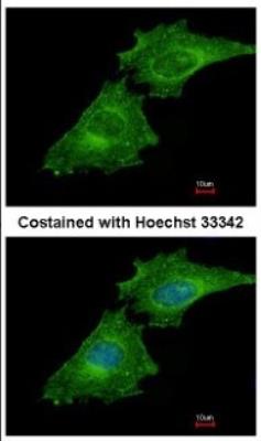 Immunocytochemistry/Immunofluorescence: Coronin 3 Antibody [NBP2-15968] - Immunofluorescence analysis of methanol-fixed HeLa, using antibody at 1:500 dilution.