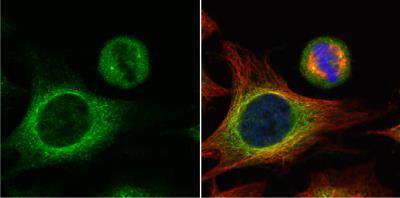 Immunocytochemistry/Immunofluorescence: HOOK2 Antibody [NBP2-14986] - HeLa cells were fixed in 4% paraformaldehyde at RT for 15 min.Green: HOOK2 protein stained by HOOK2 antibody (NBP2-14986) diluted at 1:500. Red: alpha Tubulin, a cytoskeleton marker, stained by alpha Tubulin antibody  (NBP2-43837) diluted at 1:1000. Blue: Hoechst 33342 staining.