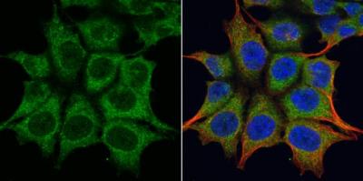Immunocytochemistry/Immunofluorescence: TRIM23 Antibody [NB100-78620] - HCT116 cells mock (left) and treated with 30 uM Cisplatin for 24 hrs (right) were fixed in 4% paraformaldehyde at RT for 15 min. Green: TRIM23 protein stained by TRIM23 antibody [N1], N-term diluted at 1:200. Red: alpha Tubulin, a cytoskeleton marker, stained by alpha Tubulin antibody [B-5-1-2] diluted at 1:10000. Blue: Hoechst 33342 staining.