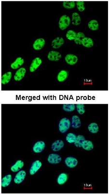 Immunocytochemistry/Immunofluorescence: hnRNP F Antibody [NBP1-33607] - Paraformaldehyde-fixed A431, using hnRNP F (NBP1-33607) antibody at 1:200 dilution.