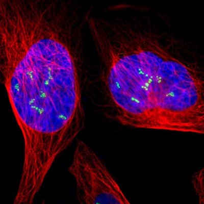 Immunocytochemistry/Immunofluorescence: UBTF Antibody [NBP1-82545] - Immunofluorescent staining of human cell line U-2 OS shows localization to nucleoli fibrillar center.