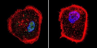 Immunocytochemistry/Immunofluorescence: RPA2 Antibody (MA34) [NB100-74526] - Analysis of RPA34 in A431 cells. Cells were grown on chamber slides and fixed with formaldehyde prior to staining. Cells were probed without (control) or with a RPA34 monoclonal antibody at a dilution of 1:200 overnight at 4C, washed with PBS and incubated with a DyLight-488 conjugated secondary antibody. RPA34 staining (green), F-Actin staining with Phalloidin (red) and nuclei with DAPI (blue) is shown.