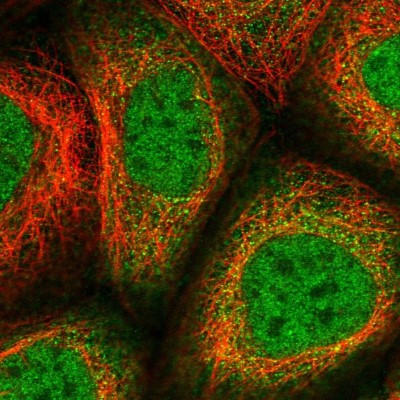 Immunocytochemistry/Immunofluorescence: SLC19A3 Antibody [NBP1-86943] - Immunofluorescent staining of human cell line A-431 shows localization to nucleoplasm & cytosol.