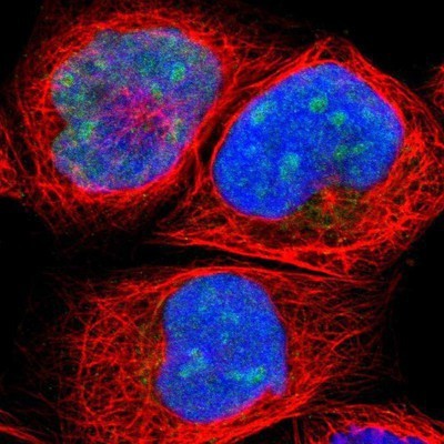 Immunocytochemistry/Immunofluorescence: HJURP Antibody [NBP1-85025] - Staining of human cell line A-431 shows positivity in nucleus and nucleoli.