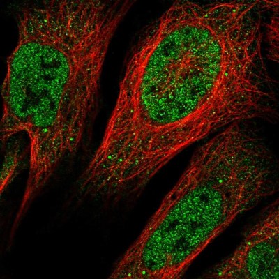 Immunocytochemistry/Immunofluorescence: Aquaporin-11 Antibody [NBP1-86208] - Staining  of human cell line U-2 OS shows positivity in nucleus but not nucleoli and vesicles.