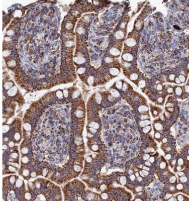 Immunohistochemistry-Paraffin: Aquaporin-11 Antibody [NBP1-86208] - Staining of human small intestine shows strong cytoplasmic positivity in glandular cells.