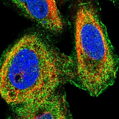 Immunocytochemistry/Immunofluorescence: Mind Bomb 1/MIB1 Antibody [NBP1-85210] - Immunofluorescent staining of human cell line U-2 OS shows localization to nuclear membrane, plasma membrane & vesicles.