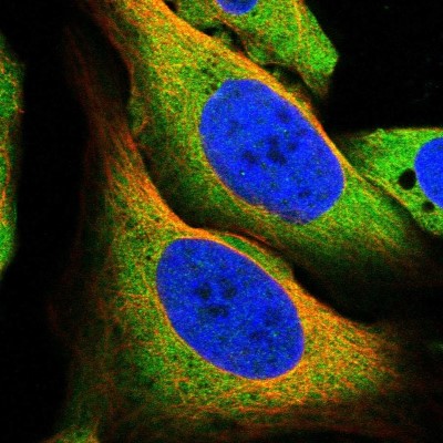Immunocytochemistry/Immunofluorescence: Mucolipin 1 Antibody [NBP1-92152] - Immunofluorescent staining of human cell line U-2 OS shows localization to plasma membrane & cytosol.