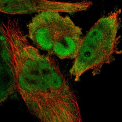 Immunocytochemistry/Immunofluorescence: CDCA7 Antibody [NBP1-82224] - Staining of human cell line U-251 MG shows localization to nucleoplasm & cytosol.
