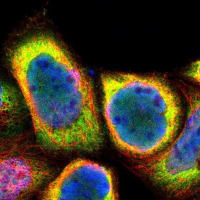 Immunocytochemistry/Immunofluorescence: CDCA7 Antibody [NBP1-82224] - Staining of human cell line A-431 shows positivity in nucleus but not nucleoli and cytoplasm.