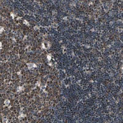 Immunocytochemistry/Immunofluorescence: CDCA7 Antibody [NBP1-82224] - Staining of human lymph node shows strong nuclear and cytoplasmic positivity in germinal and non-germinal center cells.