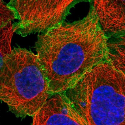 Immunocytochemistry/Immunofluorescence: SLC1A5 Antibody [NBP1-89327] - Staining of human cell line A-431 shows localization to plasma membrane.