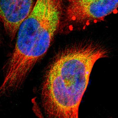 Immunocytochemistry/Immunofluorescence: FNDC3B Antibody [NBP1-90495] - Immunofluorescent staining of human cell line U-251 MG shows localization to endoplasmic reticulum.