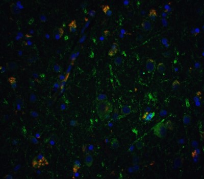 Immunocytochemistry/Immunofluorescence: Neurturin Antibody [NBP1-77047] - Staining of Neurturin in human brain tissue with Neurturin antibody at 5 ug/ml.
